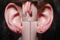 14g-Anatometal-Lobes